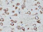 CARS Antibody in Immunohistochemistry (Paraffin) (IHC (P))