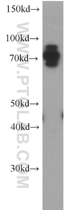 CARS Antibody in Western Blot (WB)