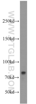 CARS Antibody in Western Blot (WB)