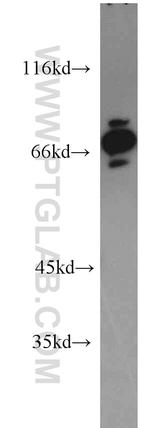 CARS Antibody in Western Blot (WB)