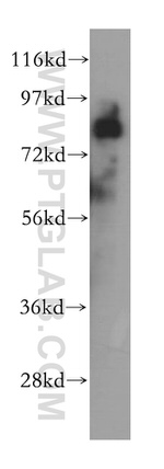 CARS Antibody in Western Blot (WB)