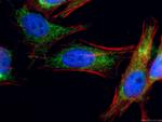 NDUFV2 Antibody in Immunocytochemistry (ICC/IF)