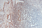 NDUFV2 Antibody in Immunohistochemistry (Paraffin) (IHC (P))