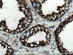 NDUFV2 Antibody in Immunohistochemistry (Paraffin) (IHC (P))