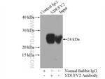 NDUFV2 Antibody in Immunoprecipitation (IP)