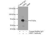GBP1 Antibody in Immunoprecipitation (IP)