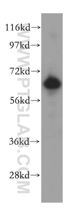 GBP1 Antibody in Western Blot (WB)