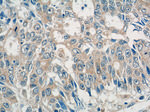 ADAMTSL4 Antibody in Immunohistochemistry (Paraffin) (IHC (P))