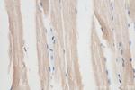 ADAMTSL4 Antibody in Immunohistochemistry (Paraffin) (IHC (P))