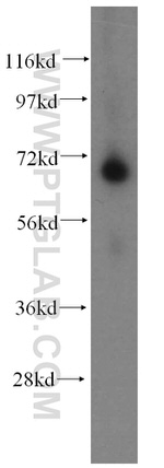 ADAMTSL4 Antibody in Western Blot (WB)