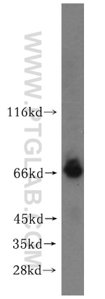 ADAMTSL4 Antibody in Western Blot (WB)