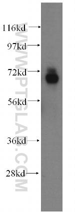 ADAMTSL4 Antibody in Western Blot (WB)