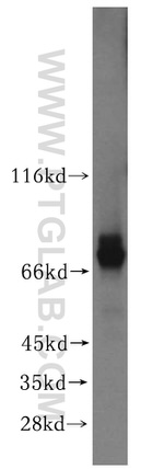 ADAMTSL4 Antibody in Western Blot (WB)