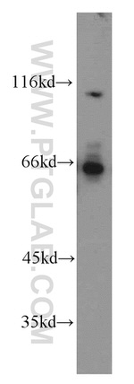 ATP6AP1 Antibody in Western Blot (WB)