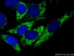 ALDH2 Antibody in Immunocytochemistry (ICC/IF)