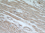 ALDH2 Antibody in Immunohistochemistry (Paraffin) (IHC (P))