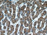 ALDH2 Antibody in Immunohistochemistry (Paraffin) (IHC (P))