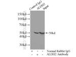 ALDH2 Antibody in Immunoprecipitation (IP)