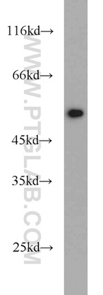 ALDH2 Antibody in Western Blot (WB)