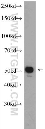 ALDH2 Antibody in Western Blot (WB)