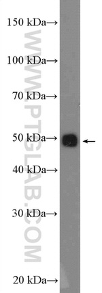 ALDH2 Antibody in Western Blot (WB)