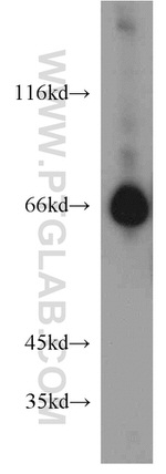 STXBP2 Antibody in Western Blot (WB)