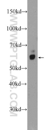 STXBP2 Antibody in Western Blot (WB)