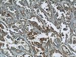 STXBP2 Antibody in Immunohistochemistry (Paraffin) (IHC (P))