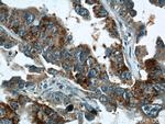 STXBP2 Antibody in Immunohistochemistry (Paraffin) (IHC (P))