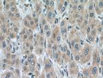 SLC25A15 Antibody in Immunohistochemistry (Paraffin) (IHC (P))