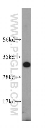 SLC25A15 Antibody in Western Blot (WB)