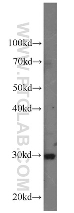 SLC25A15 Antibody in Western Blot (WB)