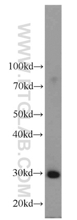 SLC25A15 Antibody in Western Blot (WB)