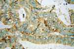 AP3S2 Antibody in Immunohistochemistry (Paraffin) (IHC (P))