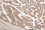 AP3S2 Antibody in Immunohistochemistry (Paraffin) (IHC (P))