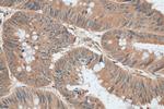 AP3S2 Antibody in Immunohistochemistry (Paraffin) (IHC (P))