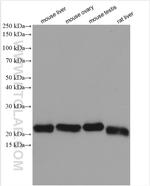 AP3S2 Antibody in Western Blot (WB)