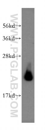 AP3S2 Antibody in Western Blot (WB)