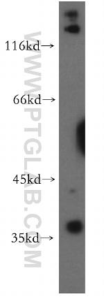 TNFAIP1 Antibody in Western Blot (WB)