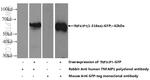 TNFAIP1 Antibody in Western Blot (WB)