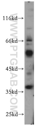 TNFAIP1 Antibody in Western Blot (WB)