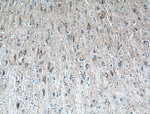 STT3B Antibody in Immunohistochemistry (Paraffin) (IHC (P))