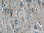 STT3B Antibody in Immunohistochemistry (Paraffin) (IHC (P))