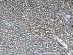 STT3B Antibody in Immunohistochemistry (Paraffin) (IHC (P))