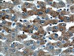 STT3B Antibody in Immunohistochemistry (Paraffin) (IHC (P))