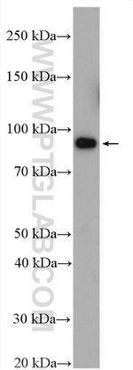 STT3B Antibody in Western Blot (WB)