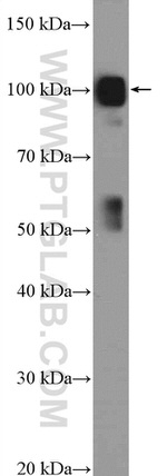 STT3B Antibody in Western Blot (WB)