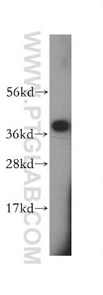 SCAMP1 Antibody in Western Blot (WB)