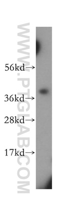 SCAMP1 Antibody in Western Blot (WB)