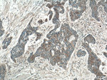 SFRP4 Antibody in Immunohistochemistry (Paraffin) (IHC (P))